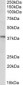 AIM2 Antibody (internal region)